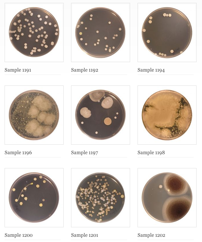 1-458-bacteria-species-new-to-science-found-in-our-belly-buttons